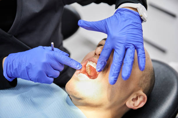 Best Emergency Root Canal Treatment in Pacific City, OR